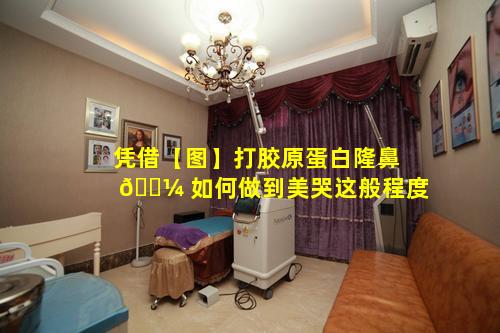 凭借【图】打胶原蛋白隆鼻 🐼 如何做到美哭这般程度